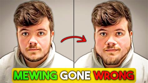 mewing danger|Mewing & Jawline Exercises .